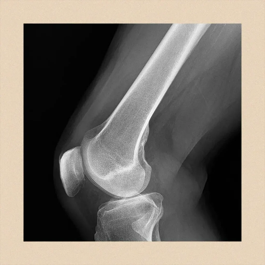 An X ray that need to be scanned