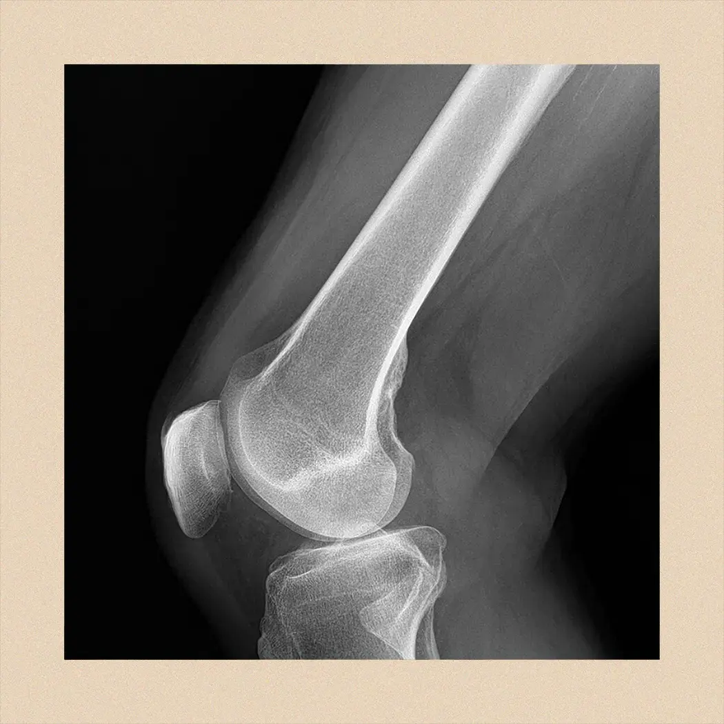 An X ray that need to be scanned